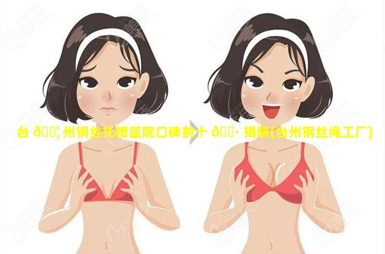 台 🐦 州钢丝托槽医院口碑前十 🕷 揭晓(台州钢丝绳工厂)